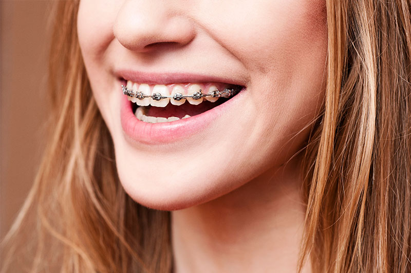 Orthodontics in Lakeview & Lincoln Square