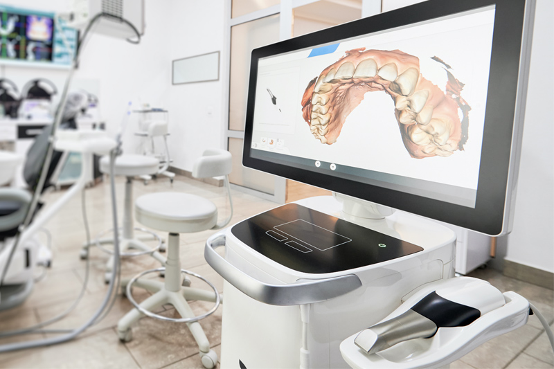 Intra-Oral Scanner in Lakeview & Lincoln Square